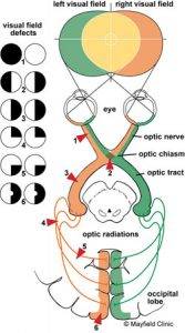 Visual Fields - Our Side Vison » Eye Care Specialists, Optometrists at ...